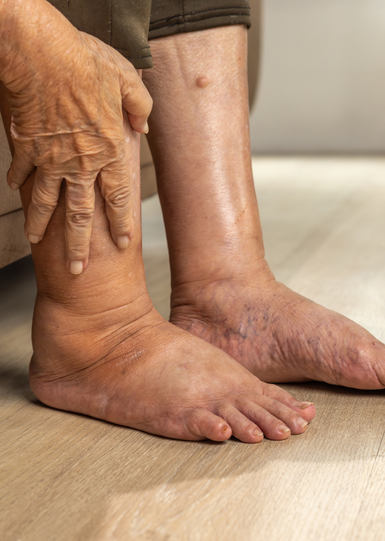 Our Services diabetic foot conditions