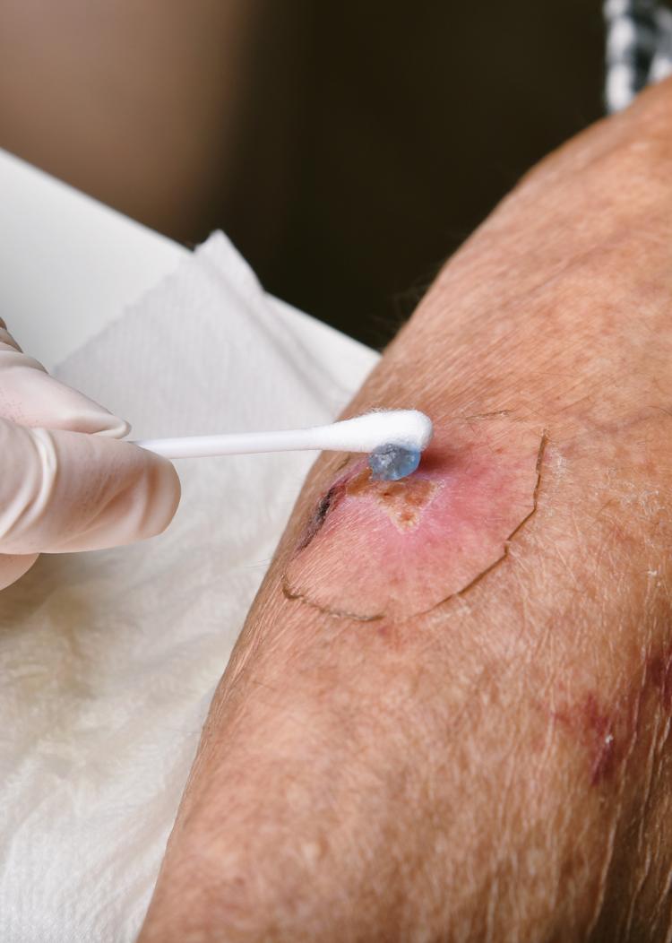 Our Services non surgical